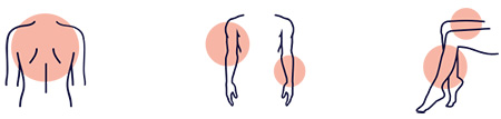 Hautpartien wie Oberkörper, Arme und Beine